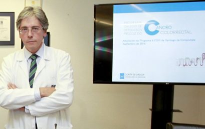 Enrique Domínguez, jefe del servicio de digestivo del CHUS: «El de colon es tan eficiente que el segundo año ya ves resultados»